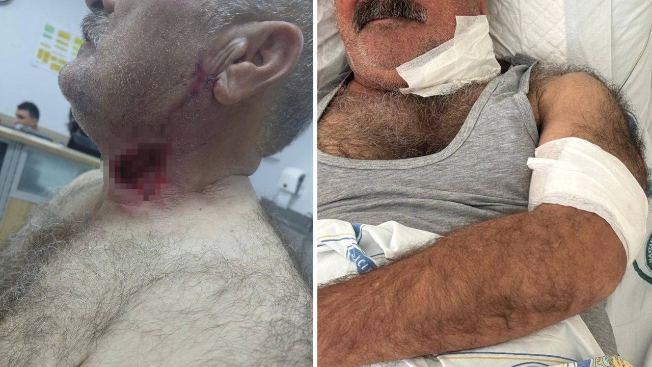 Atak Halindeki Ata Saldırıya Uğrayan Adam Hayatta Kaldı: Boğazından Isırıldı